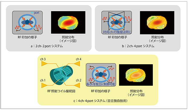 図4　照射不均一の改善技術