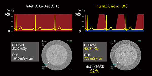 図3　IntelliEC Cardiacの概念図