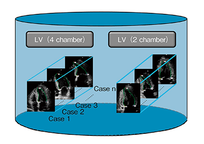図1　データベース（エキスパートによる多数の計測位置を蓄積）