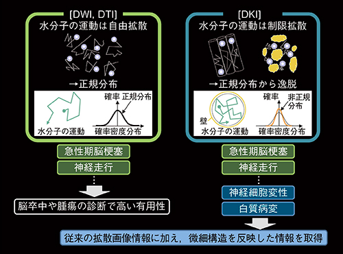 図3　DKIの撮像原理