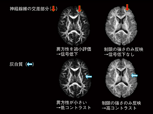 図4　FAマップとMKマップの比較