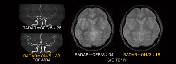 図6　RADAR画像例