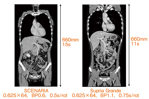 図2　SCENARIAとSupria Grandeの画質比較
