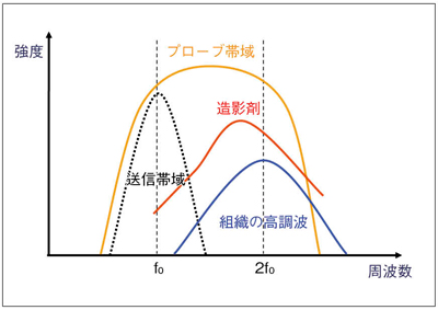 図1　WPIモードの周波数特性の概念図