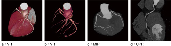 図2　IntelliCenter を使用して撮影した心臓画像