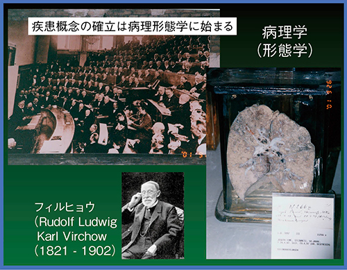 図1　Virchowが確立した病理形態学に始まる疾患概念の確立