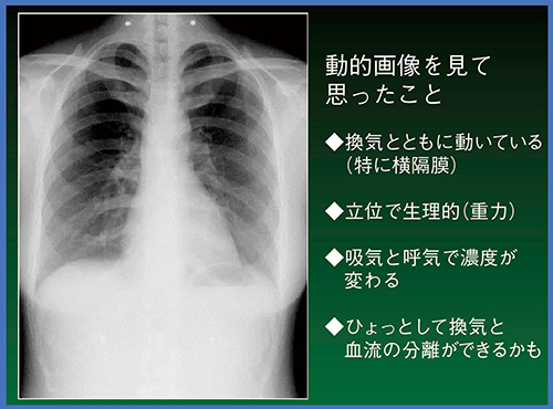 図4　X線動態画像の可能性