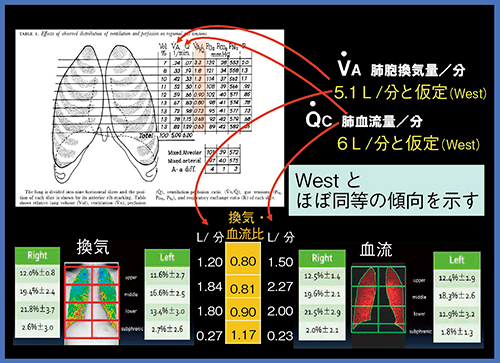 図6　X線動態画像の解析とWestの論文との比較1）