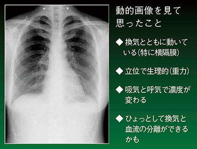 図3　胸部動態画像の印象