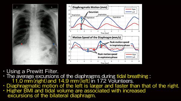 図1　胸部X線動態画像による横隔膜運動の評価