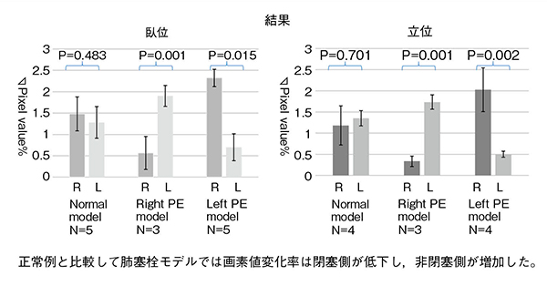 図2　正常モデルと肺塞栓モデルとの画素値変化率の比較
