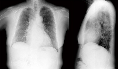 図2　症例1：胸部X線動態画像