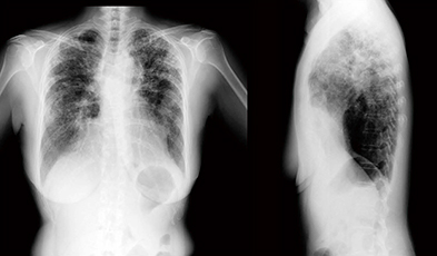 図5　症例2：胸部X線動態画像