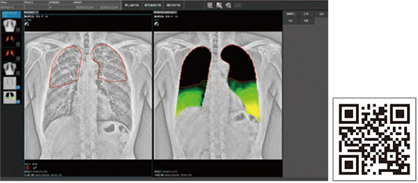 図1　FE-MODE画像（左）およびLM-MODE画像（右）