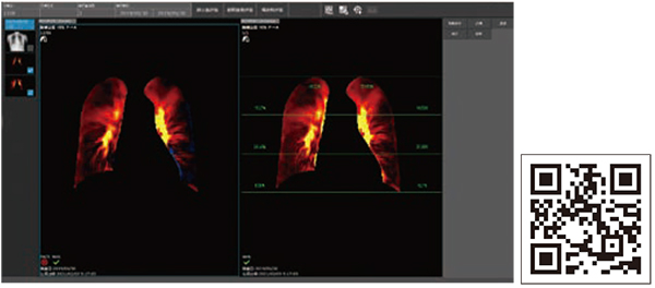 図2　PH2-MODE画像（左）およびサマリ画像（右）