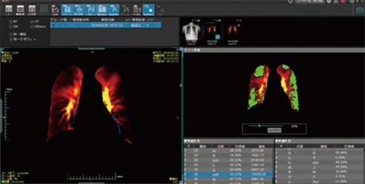 図3　Web配信ビューワで参照可能な信号値低下領域のカラー表示機能