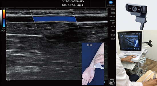 図2　カメラリンク機能