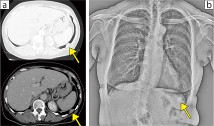 図3　症例3：疾患の鑑別に役立った症例