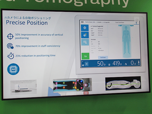 AIカメラによる自動ポジショニング“Precise Position”