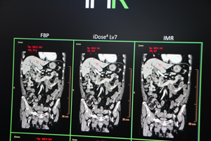 「IMR」では，大幅にノイズを低減させることが可能
