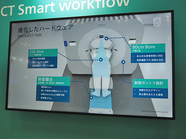 「Spectral CT 7500」の進化したハードウエア