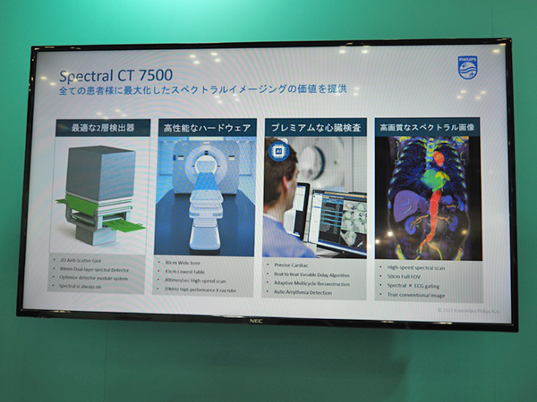 「Spectral CT 7500」が提供する価値