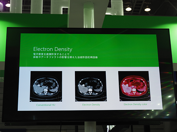 治療計画への応用が期待される“Electron Density”