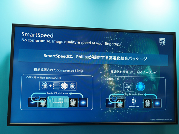 高速イメージング「SmartSpeed」