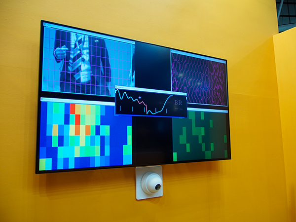 咳などで呼吸が乱れても適切に呼吸同期を行う“VitalEye”