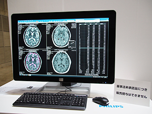 1回の撮像で多様なシーケンス画像を得られる“SyntheticMR”（医薬品医療機器等法未承認品）