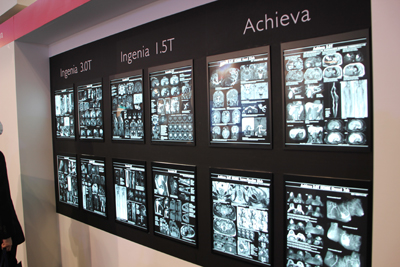 日本の医療機関で撮像されたIngeniaの画像をフィルムで展示