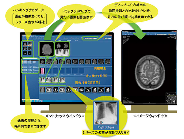 図1　IDS7 PACSのユーザインタフェイス