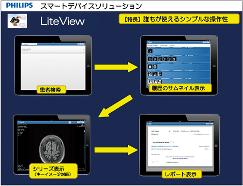 図2　LiteViewにおける画像表示の流れ