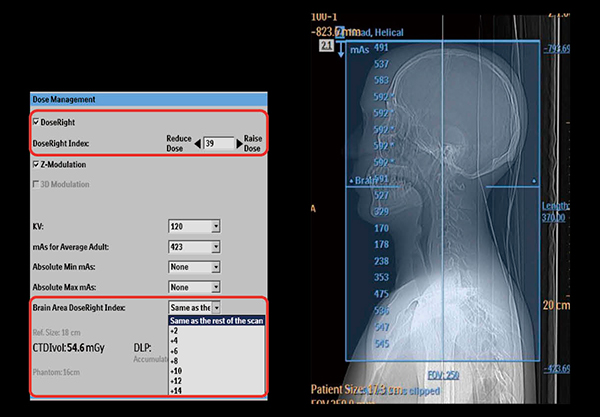 図3　Brain Area Dose Right Index