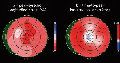 図4　Bull’s eye表示 a：peak-systolic strain　b：time-to-peak