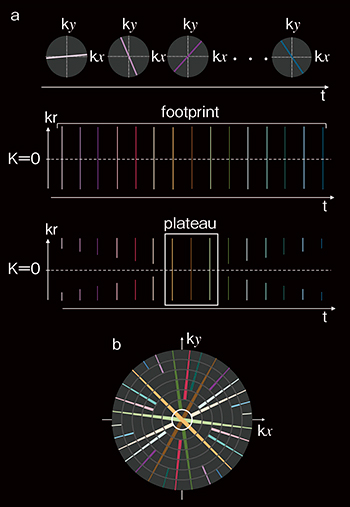 図1　KWIC filter a：spokeの表示方法とKWIC filterのコンセプト b：kx-ky面の二次元におけるKWIC filterのストラテジー