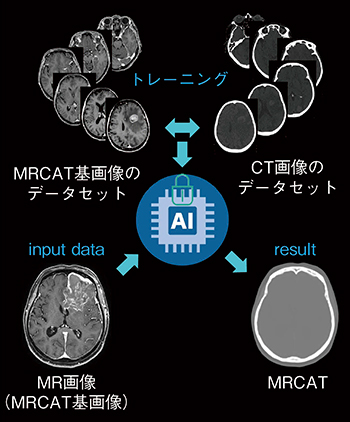図3　MRCAT Brainの生成プロセス