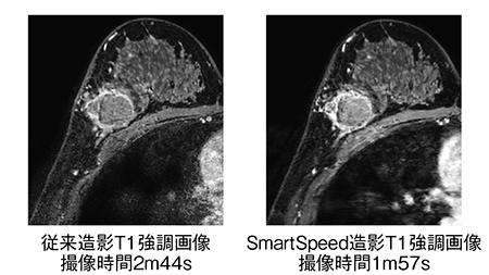 図2　SmartSpeedと従来法の比較（画像ご提供：東京警察病院様）