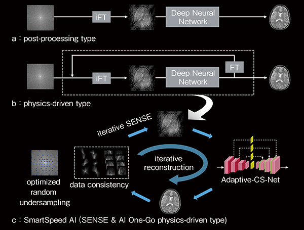 図1　画像再構成フローに基づいたDeep Learning Reconstruction（DLR）の分類