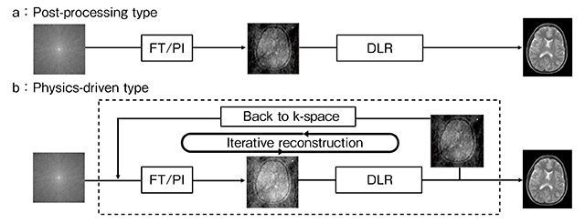 図1　DLRを用いた画像再構成タイプ a：フーリエ変換（FT）あるいはPIなど，従来画像再構成後にDLR処理を行うpost-processing type。 b：FTあるいはPIとDLRをハイブリッドで用いるphysics-driven type。DLR処理後，画像空間からk空間に再変換し（back to k-space），再びFT/PIを行っていく反復スキームとなる。