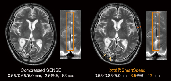 図3　脳T2強調画像における臨床応用例 （画像ご提供：東京警察病院様）