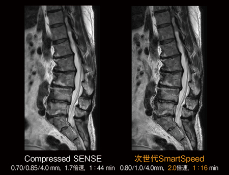 図4　腰椎T2強調画像における臨床応用例 （画像ご提供：東京警察病院様）