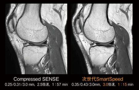 図5　膝関節プロトン密度強調画像における臨床応用例 （画像ご提供：東京警察病院様）