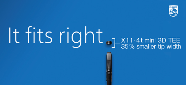 図2　細径3D経食道トランスジューサX11-4t