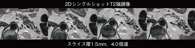 図3　SmartSpeed Preciseの臨床応用例（膵臓） （画像ご提供：熊本中央病院）