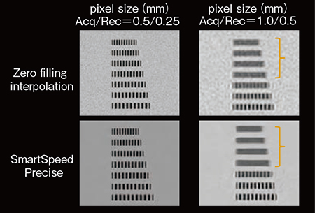 図4　収集ボクセルサイズに依存する真の空間分解能：Zero filling interpolationとSmartSpeed Preciseの比較
