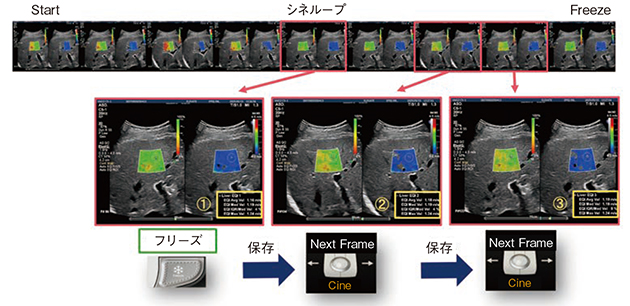 図2　計測フレームの自動選択 Auto ElastQは，2D-SWEカラー画像のシネループ内から最大3フレームを自動で選択，カラーボックス内に自動で計測ROIを配置し，計測結果を表示する。