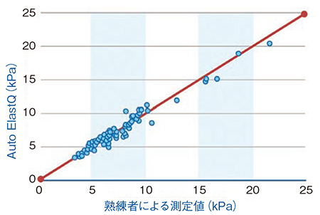 図4　同じデータに対するAuto ElastQと熟練者による測定の比較