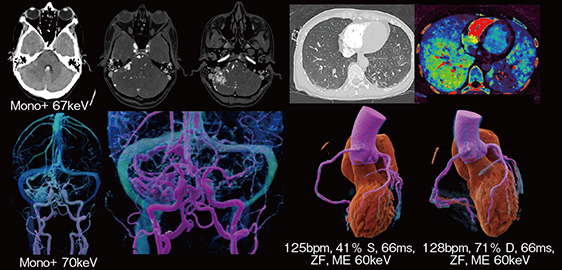 図8　高い時間分解能を生かした重症患者の撮影