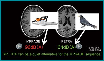 図2　qPETRA：3T装置の臨床画像の比較 a：MPRAGE〔96dB（A）〕，b：qPETRA〔64dB（A）〕